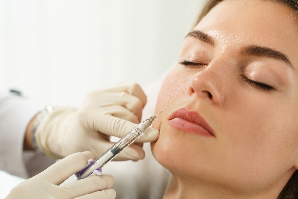 Close up of a beautiful young woman having hyaluronic acid filler injected around her marionette lines.