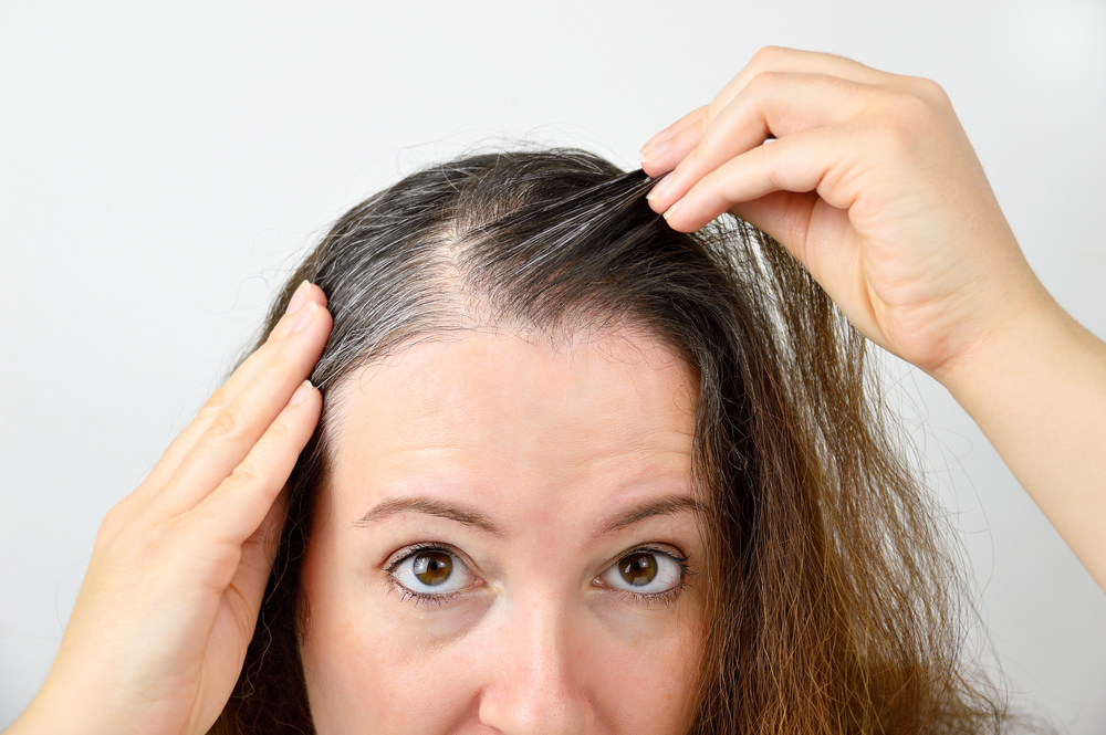 Close up of a woman looking closely at thee balding and thinning spots in her hair.